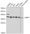Insulin Like Growth Factor Binding Protein 7 antibody, 18-893, ProSci, Western Blot image 