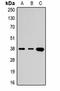 TATA-Box Binding Protein antibody, orb323198, Biorbyt, Western Blot image 