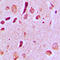 JIP-3 antibody, LS-C353338, Lifespan Biosciences, Immunohistochemistry frozen image 