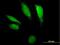 Deoxyribonuclease 2, Lysosomal antibody, H00001777-B01P, Novus Biologicals, Immunofluorescence image 