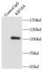 Kinesin Family Member 18A antibody, FNab04553, FineTest, Immunoprecipitation image 