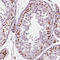 CCCTC-Binding Factor antibody, AMAb90666, Atlas Antibodies, Immunohistochemistry paraffin image 
