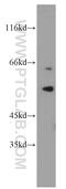 Ribosomal Protein S6 Kinase B2 antibody, 15268-1-AP, Proteintech Group, Western Blot image 