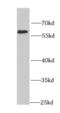 Karyopherin Subunit Alpha 4 antibody, FNab04636, FineTest, Western Blot image 