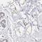 Chromosome 19 Open Reading Frame 12 antibody, NBP1-94063, Novus Biologicals, Immunohistochemistry frozen image 