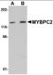 Myosin Binding Protein C, Fast Type antibody, orb94370, Biorbyt, Western Blot image 