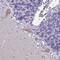 Divergent Protein Kinase Domain 1B antibody, NBP2-14576, Novus Biologicals, Immunohistochemistry frozen image 