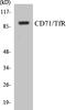 Transferrin Receptor antibody, EKC1102, Boster Biological Technology, Western Blot image 