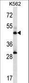 Adenylosuccinate synthetase isozyme 2 antibody, LS-C161014, Lifespan Biosciences, Western Blot image 