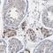 Ring Finger Protein 25 antibody, HPA036421, Atlas Antibodies, Immunohistochemistry paraffin image 