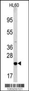 BCL2 Associated Agonist Of Cell Death antibody, TA324511, Origene, Western Blot image 