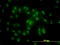 Proteasome 26S Subunit, ATPase 6 antibody, LS-C198020, Lifespan Biosciences, Immunofluorescence image 