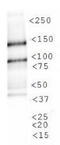 Lysine Demethylase 3A antibody, TA336794, Origene, Western Blot image 