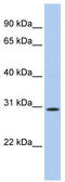 TP53 Target 5 antibody, TA335621, Origene, Western Blot image 
