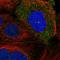 Serologically Defined Colon Cancer Antigen 8 antibody, HPA025737, Atlas Antibodies, Immunofluorescence image 