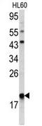 Actin Related Protein 2/3 Complex Subunit 3 antibody, AP17132PU-N, Origene, Western Blot image 