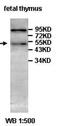 Aminocarboxymuconate Semialdehyde Decarboxylase antibody, orb77650, Biorbyt, Western Blot image 