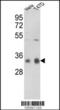 Serine/threonine-protein phosphatase PP1-gamma catalytic subunit antibody, 63-466, ProSci, Western Blot image 
