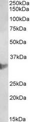 Chloride Intracellular Channel 1 antibody, TA326744, Origene, Western Blot image 