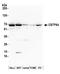 Cleavage Stimulation Factor Subunit 2 antibody, A301-092A, Bethyl Labs, Western Blot image 