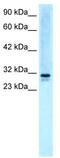 SNF8 Subunit Of ESCRT-II antibody, TA329321, Origene, Western Blot image 