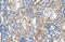 Mineralocorticoid receptor antibody, ARP45599_T100, Aviva Systems Biology, Immunohistochemistry paraffin image 