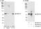 DEAD-Box Helicase 18 antibody, A300-636A, Bethyl Labs, Immunoprecipitation image 