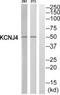 Potassium Voltage-Gated Channel Subfamily J Member 4 antibody, PA5-39601, Invitrogen Antibodies, Western Blot image 