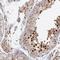 Protein Serine Kinase H1 antibody, HPA053927, Atlas Antibodies, Immunohistochemistry frozen image 