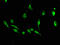 Dickkopf WNT Signaling Pathway Inhibitor 1 antibody, A64088-100, Epigentek, Immunofluorescence image 