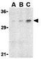 Adiponectin, C1Q And Collagen Domain Containing antibody, GTX31719, GeneTex, Western Blot image 