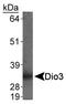 Iodothyronine Deiodinase 3 antibody, NBP1-05767, Novus Biologicals, Western Blot image 