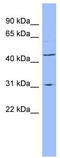 Dihydroorotate Dehydrogenase (Quinone) antibody, TA346256, Origene, Western Blot image 