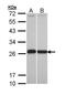 Glutathione S-transferase P 1 antibody, PA5-29601, Invitrogen Antibodies, Western Blot image 