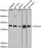 Dimethylarginine Dimethylaminohydrolase 2 antibody, MBS129974, MyBioSource, Western Blot image 