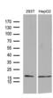 Translocase Of Inner Mitochondrial Membrane 8A antibody, LS-C795124, Lifespan Biosciences, Western Blot image 