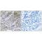 MPC2 antibody, A08029, Boster Biological Technology, Immunohistochemistry paraffin image 
