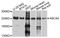 ATP Binding Cassette Subfamily A Member 4 antibody, A10556, ABclonal Technology, Western Blot image 