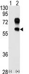 Kringle Containing Transmembrane Protein 1 antibody, AP11560PU-N, Origene, Western Blot image 