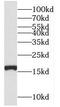 Nudix Hydrolase 2 antibody, FNab05903, FineTest, Western Blot image 
