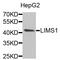 LIM Zinc Finger Domain Containing 1 antibody, A6384, ABclonal Technology, Western Blot image 