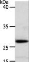 Retinoic Acid Receptor Responder 1 antibody, LS-C402827, Lifespan Biosciences, Western Blot image 