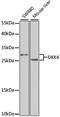 Dickkopf WNT Signaling Pathway Inhibitor 4 antibody, A7797, ABclonal Technology, Western Blot image 