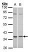 Complement Component 5a Receptor 2 antibody, TA308708, Origene, Western Blot image 