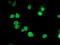 PBX Homeobox 1 antibody, LS-C173146, Lifespan Biosciences, Immunofluorescence image 