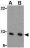Presenilin Enhancer, Gamma-Secretase Subunit antibody, GTX85063, GeneTex, Western Blot image 