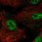 Nuclear Receptor Subfamily 0 Group B Member 1 antibody, HPA061948, Atlas Antibodies, Immunofluorescence image 