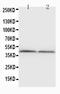 NPHS2 Stomatin Family Member, Podocin antibody, PA1322, Boster Biological Technology, Western Blot image 