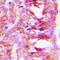 Potassium Two Pore Domain Channel Subfamily K Member 15 antibody, LS-C354189, Lifespan Biosciences, Immunohistochemistry paraffin image 