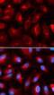 Kinesin Light Chain 1 antibody, FNab04594, FineTest, Immunofluorescence image 